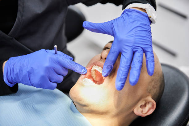 Best Emergency Tooth Extraction in Nixon, TX